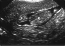 ISTEROSCOPIA DIAGNOSTICA ED OPERATIVA